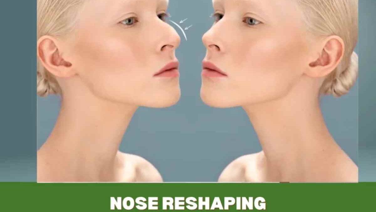 Benefit From Nose Reshaping – Introduction, Best And More