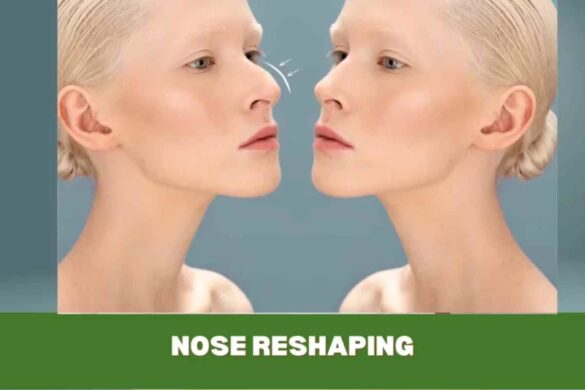 Benefit From Nose Reshaping