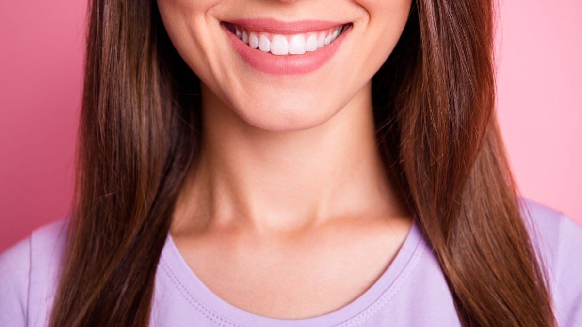 Do Porcelain Veneers Stain?