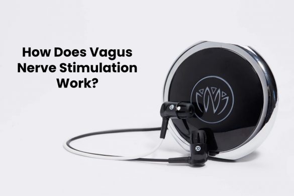 How Does Vagus Nerve Stimulation Work