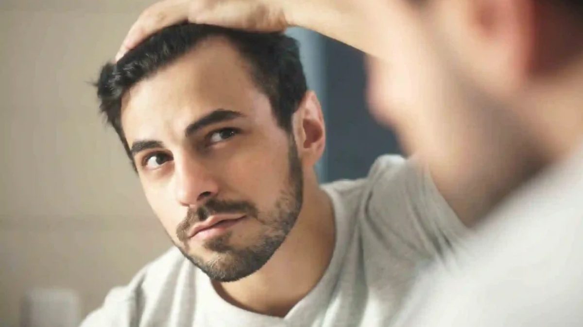 7 Key Points to Consider Before Getting a Hair Transplant