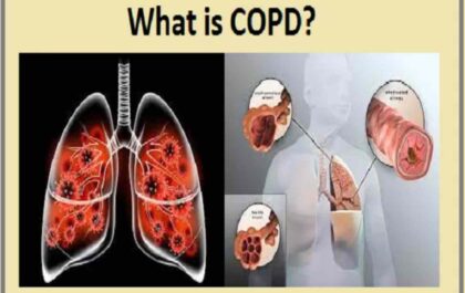 Is COPD Contagious