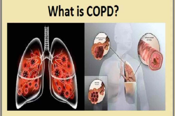 Is COPD Contagious