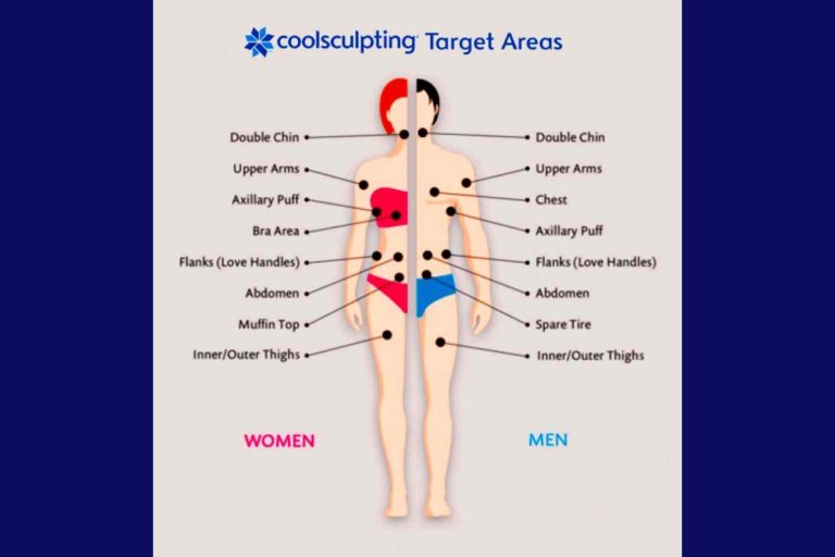 What Areas Can You Target With Coolsculpting?