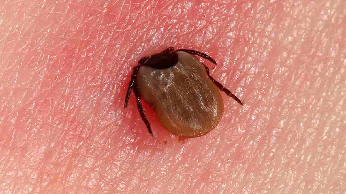 Verschleppte Borreliose-Symptome