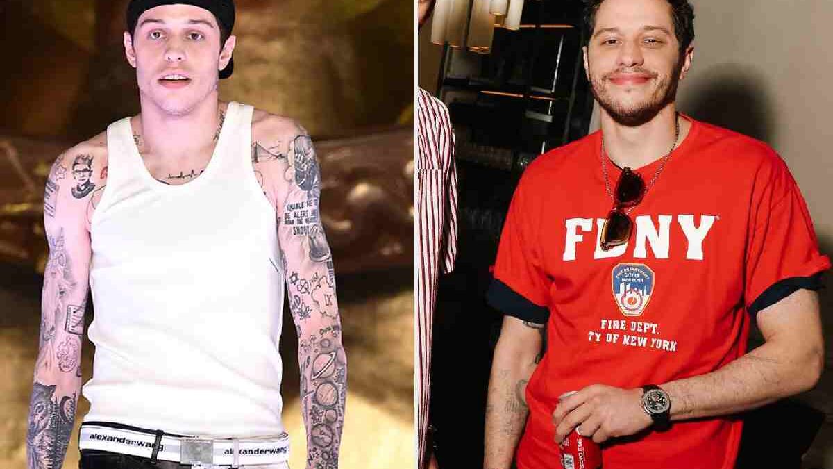 Pete Davidson Tattoo Removal