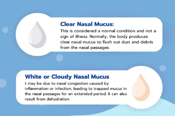 Understanding Thick Rubbery White Mucus from the Nose_